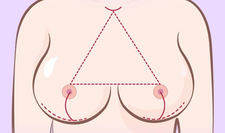 Xương đòn và đầu ngực, khoảng cách giữa đầu ngực và đầu ngực, vị trí đầu ngực dựa theo đường chân ngực, dựa vào tỉ lệ thực tế của các yếu tố trên quyến định hình thái khuôn ngực đẹp.