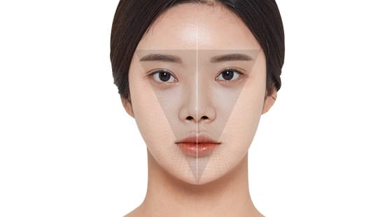 Nắn thẳng hình dạng của hàm trước và căn chỉnh đường trung tâm của khuôn mặt