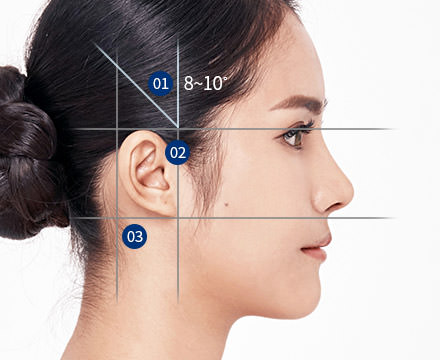 Tỷ lệ và góc độ của tai khi nhìn từ một bên